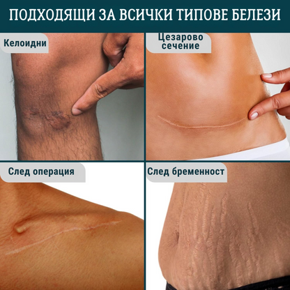 Корейски силиконови ленти